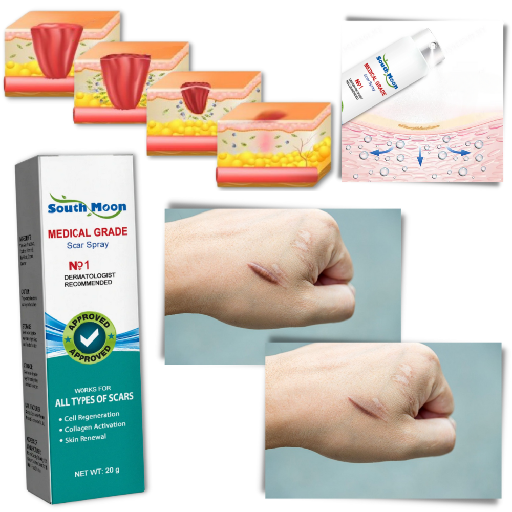 Spray terapia para eliminar cicatrices x 2 Unidades