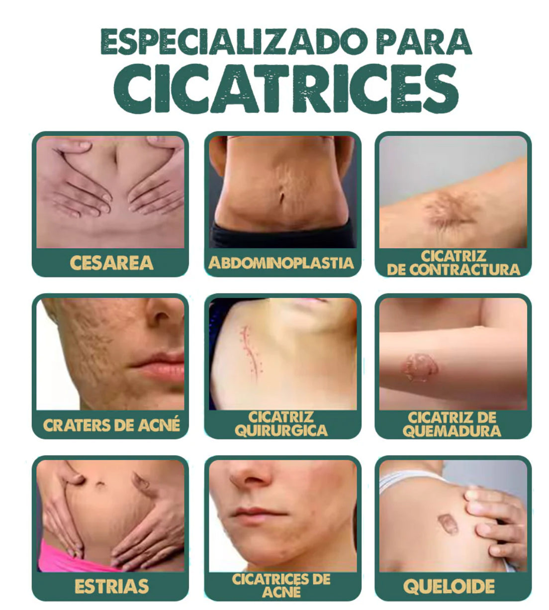 Spray terapia para eliminar cicatrices x 2 Unidades