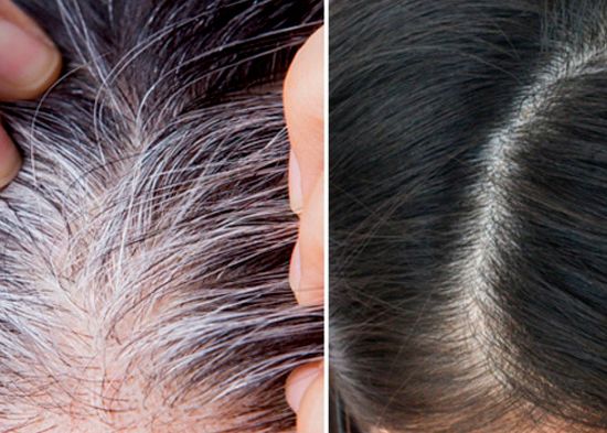 Shampoo CUBRECANAS + Obsequio MAXIPLUS